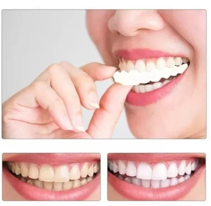 OFERTA 2x1 - Carillas Dentales Perfecta Sonrisa