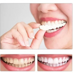 OFERTA 2x1 - Carillas Dentales Perfecta Sonrisa